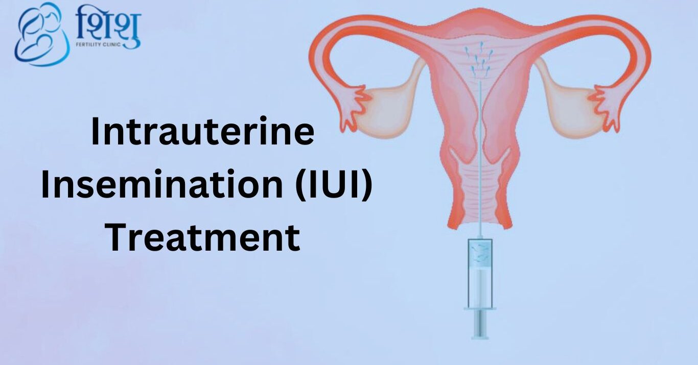 Intrauterine insemination (IUI) treatment in Nepal