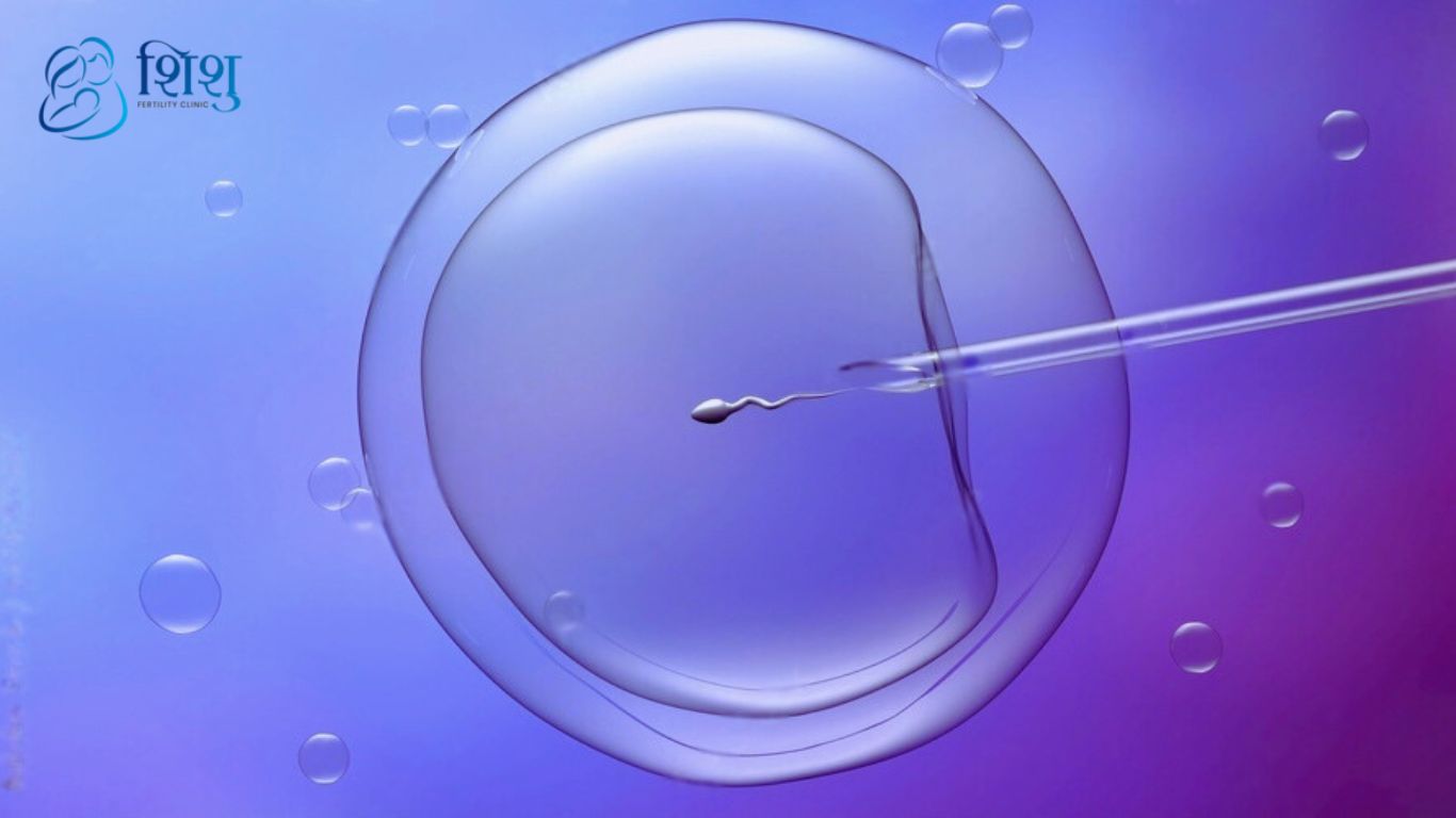 IVF treatment in Sishu fertility clinic