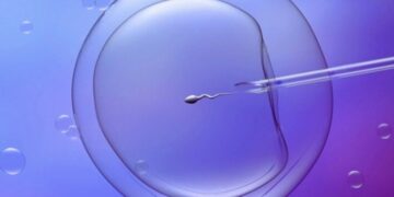 How to Get Pregnant with PCOS Quickly? A Complete Guide
